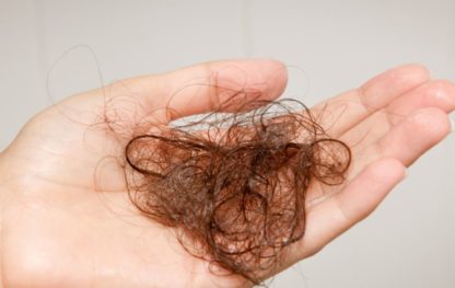 Vypadávanie vlasov – ako mu zabrániť?